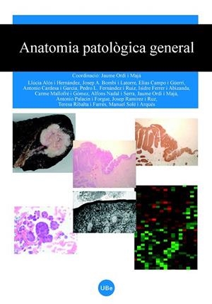 ANATOMIA PATOLOGICA GENERAL | 9788447531295 | ORDI I MAJA, JAUME (COORD.) | Llibreria La Gralla | Librería online de Granollers