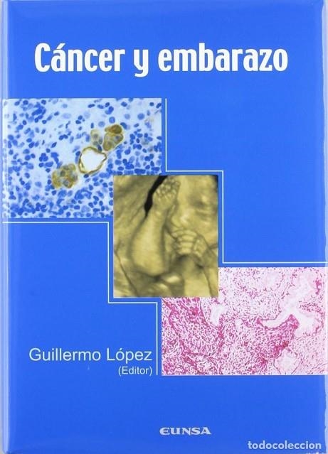 CANCER Y EMBARAZO | 9788431324490 | LOPEZ, GUILLERMO (ED) | Llibreria La Gralla | Librería online de Granollers