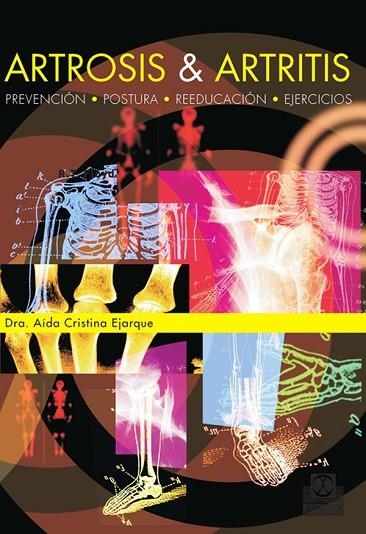 ARTROSIS & ARTRITIS | 9788480190404 | CRISTINA EJARQUE, AIDA | Llibreria La Gralla | Librería online de Granollers