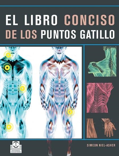 LIBRO CONCISO DE LOS PUNTOS GATILLO, EL | 9788480191319 | NIEL ASHER, SIMEON | Llibreria La Gralla | Librería online de Granollers