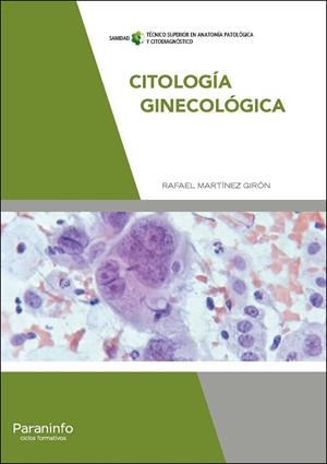 CITOLOGÍA GINECOLÓGICA | 9788428338059 | MARTINEZ GIRON, RAFAEL | Llibreria La Gralla | Llibreria online de Granollers