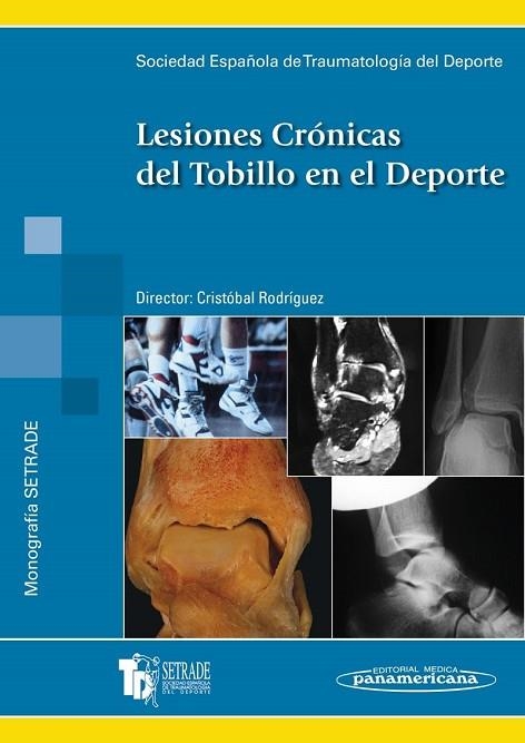 LESIONES CRONICAS TOBILLO DEP. | 9788479037925 | SETRADE SOCIEDAD ESPAÑOLA DE TRAUMATOLOGÍA DEL DEPORTE / CRISTÓBAL RODRÍGUEZ HERNÁNDEZ | Llibreria La Gralla | Llibreria online de Granollers