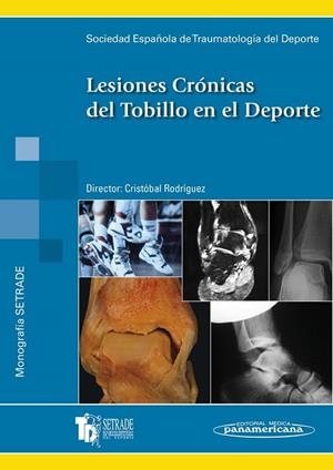 LESIONES CRONICAS TOBILLO DEP. | 9788479037925 | SETRADE SOCIEDAD ESPAÑOLA DE TRAUMATOLOGÍA DEL DEPORTE / CRISTÓBAL RODRÍGUEZ HERNÁNDEZ | Llibreria La Gralla | Llibreria online de Granollers
