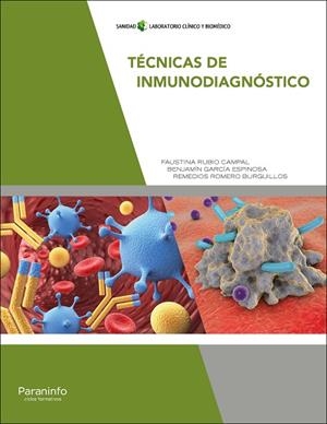 TÉCNICAS DE INMUNODIAGNÓSTICO | 9788497329934 | GARCÍA ESPINOSA, BENJAMÍN / RUBIO CAMPAL, FAUSTINA / ROMERO BURGUILLOS, REMEDIOS | Llibreria La Gralla | Llibreria online de Granollers