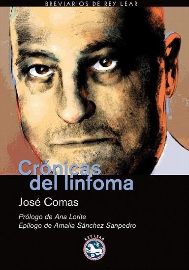 CRONICAS DEL LINFOMA | 9788492403257 | COMAS, JOSE | Llibreria La Gralla | Librería online de Granollers